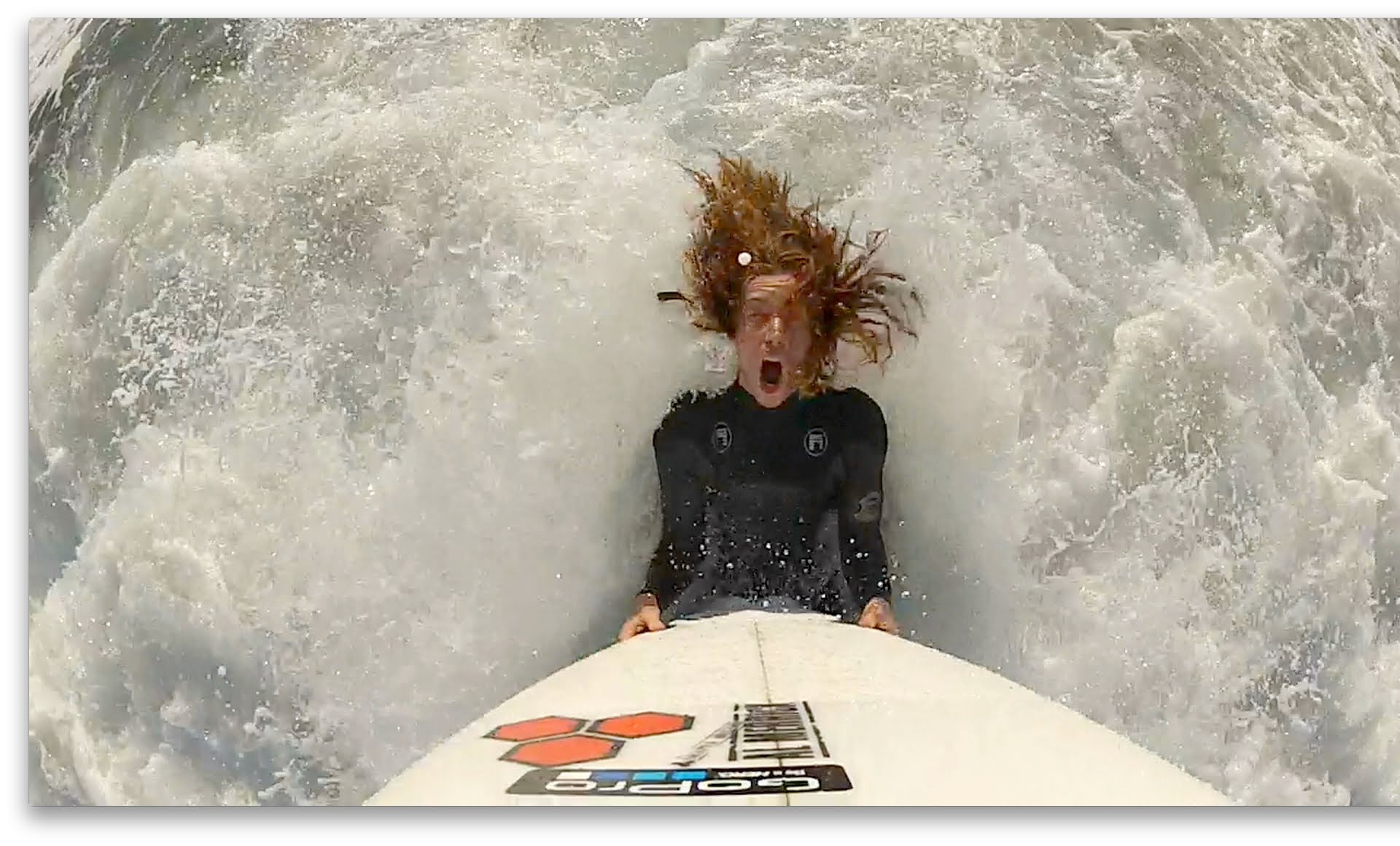 Shaun White Backyard Surf Sessions